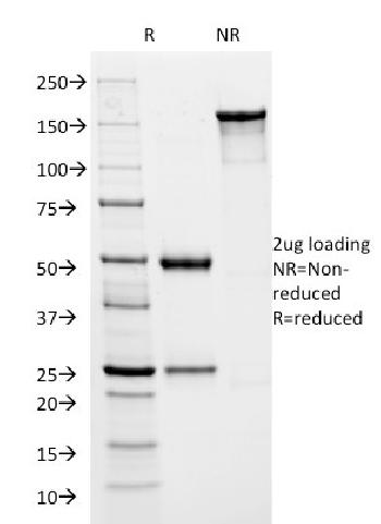 Anti-HSV1 (Herpes Simplex Virus Type I) ICP8 Monoclonal Antibody(Clone: HSVI/2045)