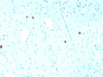 Anti-HPV-16 (Human Papilloma Virus 16) Monoclonal Antibody(Clone: rHPV16L1/1058)