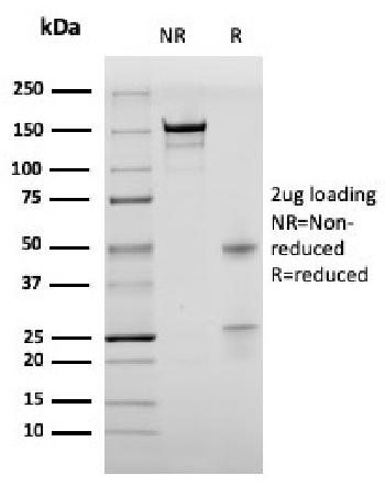 Anti-Bromodeoxyuridine (BrdU) (Proliferation Marker) Monoclonal Antibody(Clone: rBRD469)