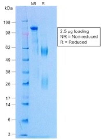 Anti-Negative Control for Rabbit Monoclonal Antibodies Monoclonal Antibody(Clone: NCRBM/1520R)