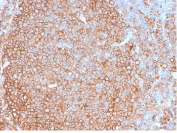 Anti-HLA-Pan (MHC II) Monoclonal Antibody(Clone: HLA-Pan/2967R)