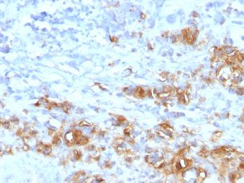 Anti-CA19-9/Sialyl Lewisa (GI Tumor Marker) Monoclonal Antibody(Clone: CA19.9/1390R)