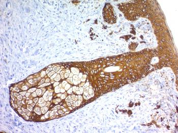 Anti-Cytokeratin, Basic (Type II or HMW) (Epithelial Marker) Monoclonal Antibody(Clone: KRTH/1576R)