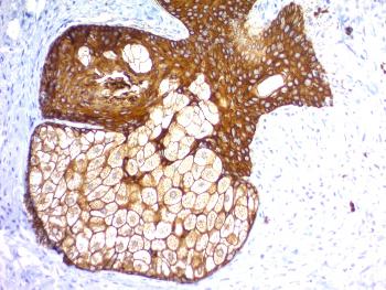 Anti-Cytokeratin, pan (Epithelial Marker) Monoclonal Antibody(Clone: KRTH/1576R + KRTL/1577R)