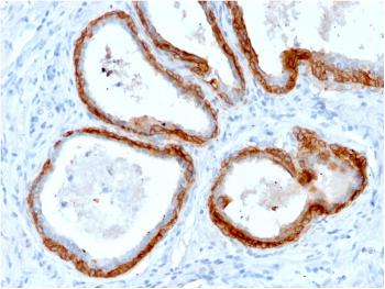 Anti-Cytokeratin, Basic (Type II or HMW) Monoclonal Antibody(Clone: KRTH/2147R)