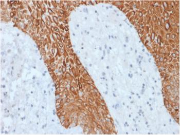 Anti-Cytokeratin, Multi (Epithelial Marker) Monoclonal Antibody(Clone: KRT/1877R)