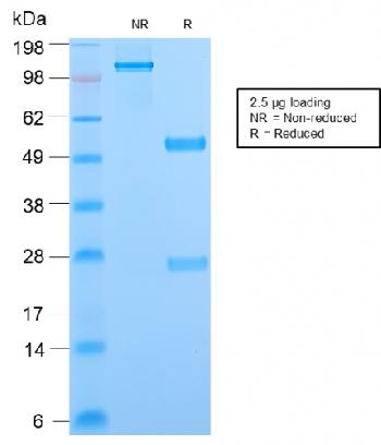 Anti-Phosphotyrosine (P-Tyr) Monoclonal Antibody(Clone: PY2870R)