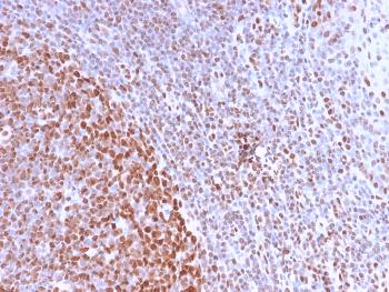 Anti-Nuclear Antigen (Pan-Nuclear Marker) Monoclonal Antibody(Clone: NM2984R)