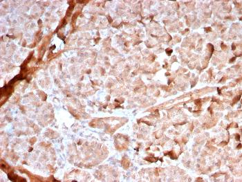 Anti-Mitochondria (Marker for Human Cells, Granular RCC's & Salivary Tumors) Monoclonal Antibody(Clone: MTC02/2860R)