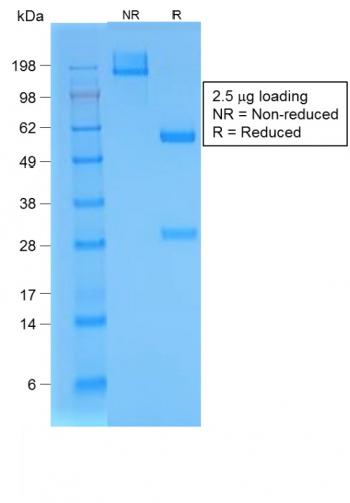 Anti-Bromodeoxyuridine (BrdU) (Proliferation Marker) Monoclonal Antibody(Clone: BRD/1539R)