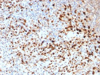 Anti-HSV1 (Herpes Simplex Virus Type I) Polyclonal Antibody