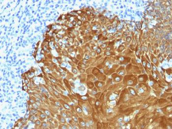 Anti-Cytokeratin, pan (Epithelial Marker) Polyclonal Antibody