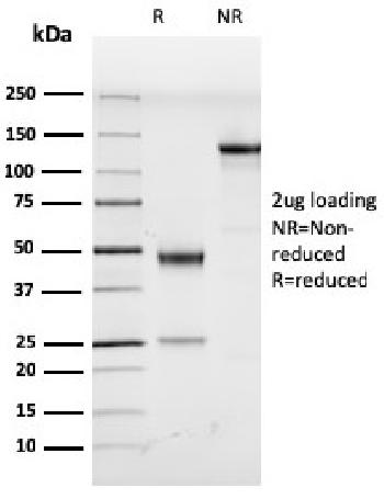 Anti-Human Herpes Virus 8 (HHV8) Monoclonal Antibody(Clone: LN53)