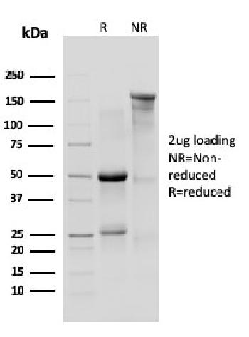 Anti-IL-10R1, Mouse (Interleukin-10 Receptor 1) (CD210) Monoclonal Antibody(Clone: 1B1.3a)