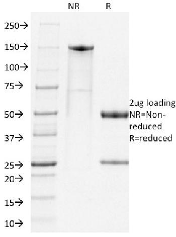 Anti-PD1, Mouse Monoclonal Antibody(Clone: RMP1-14)