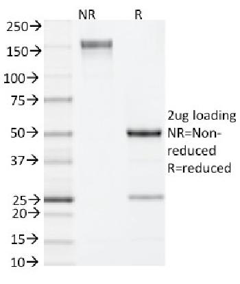 Anti-IL-4 (Interleukin-4), Mouse Monoclonal Antibody(Clone: 11B11)