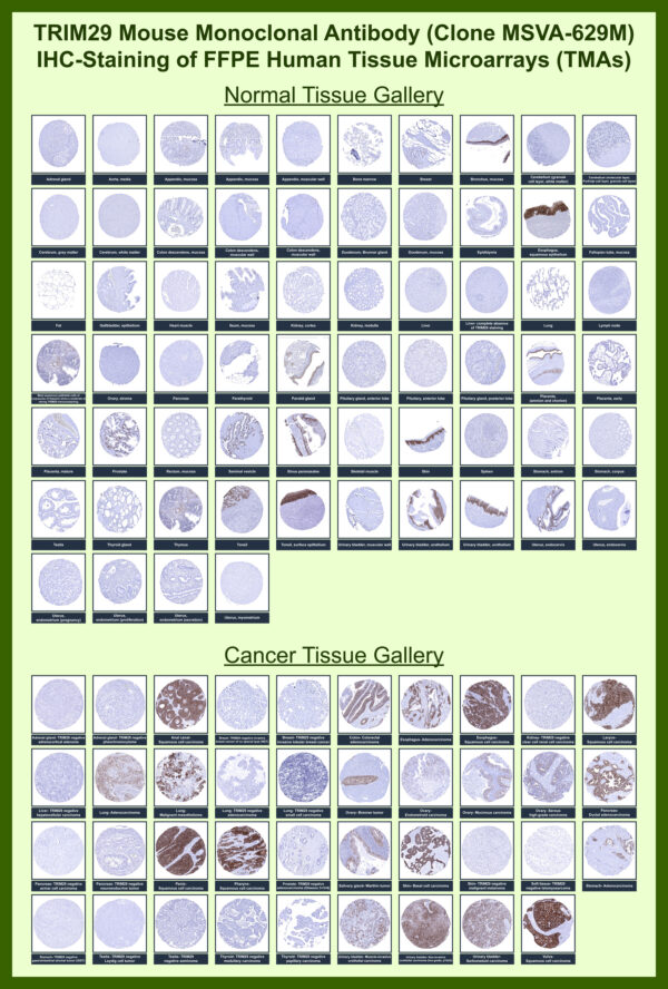 Monoclonal Antibody to TRIM29 (Lung Squamous Cell Carcinoma Marker)(Clone : MSVA-629M)
