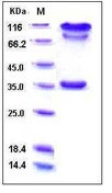 Human BACE1 / ASP2 Recombinant Protein (Fc Tag)(Discontinued)