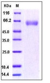 Human BACE1 / ASP2 Recombinant Protein (His Tag)(Discontinued)