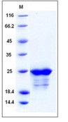 Human SMAC / Diablo Recombinant Protein (His Tag)(Discontinued)