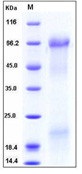 Human Osteopontin / SPP1 / ETA-1 Recombinant Protein (His Tag)(Discontinued)