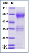 Human TIM-3 / HAVCR2 Recombinant Protein (Fc Tag)(Discontinued)