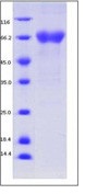 Human TIM-3 / HAVCR2 Recombinant Protein (His & Fc Tag)(Discontinued)