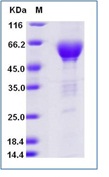 Human TIM-3 / HAVCR2 Recombinant Protein (Fc Tag)(Discontinued)