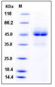 Human TRAIL R1 / CD261 / TNFRSF10A Recombinant Protein (Fc Tag)(Discontinued)