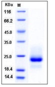 Human TRAIL R1 / CD261 / TNFRSF10A Recombinant Protein (His Tag)(Discontinued)