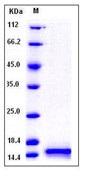 Human Cystatin B / CSTB Recombinant Protein (His Tag)(Discontinued)