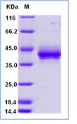 Human TNFRSF17 / BCMA (CD269) Recombinant Protein (Fc tag)(Discontinued)