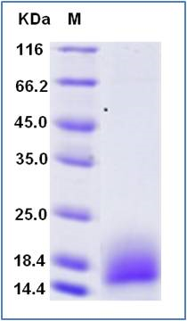 Human TNFRSF17 / BCMA (CD269) Recombinant Protein (His Tag)(Discontinued)