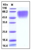 Human CD86 / B7-2 Recombinant Protein (His Tag)(Discontinued)