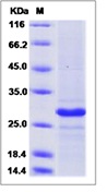 Human CD20 / MS4A1 Recombinant Protein (TrxA Tag)(Discontinued)