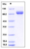 Mouse BCAM Recombinant Protein (His Tag)(Discontinued)