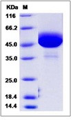 Mouse GM-CSF / CSF2 Recombinant Protein (Fc Tag)(Discontinued)