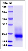 Mouse GM-CSF / CSF2 Recombinant Protein (His Tag)(Discontinued)