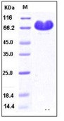 Human CD112 / Nectin-2 / PVRL2 Recombinant Protein (Fc Tag)(Discontinued)