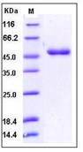 Human CD112 / Nectin-2 / PVRL2 Recombinant Protein (His Tag)(Discontinued)