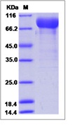 Human VEGFR2 / Flk-1 / CD309 / KDR Recombinant Protein (Domain 1&2&3, Fc Tag)(Discontinued)