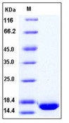 Human bFGF / FGF2 Recombinant Protein(Discontinued)