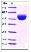 Human GM-CSF / CSF2 Recombinant Protein (Fc Tag)(Discontinued)