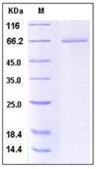 Human CD27 / TNFRSF7 Recombinant Protein (His & Fc Tag)(Discontinued)