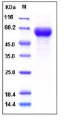 Human CD153 / CD30L / TNFSF8 Recombinant Protein (Fc Tag)(Discontinued)