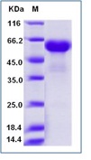 Human CD137 / 4-1BB Recombinant Protein (Fc Tag)(Discontinued)