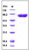 Human CD137 / 4-1BB / TNFRSF9 Recombinant Protein (His & Fc Tag)(Discontinued)