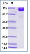 Human CD166 / ALCAM Recombinant Protein (Fc Tag)(Discontinued)