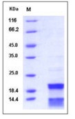 Human CASP7 / caspase 7 / MCH3 Recombinant Protein (His Tag)(Discontinued)