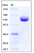 Human ANPEP / CD13 Recombinant Protein (603 Met/Ile, His Tag)(Discontinued)